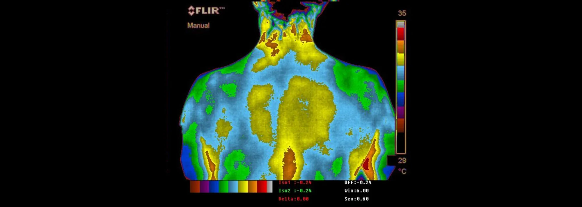 studie_rueckenschmerzen_entzuendung_nach_erdung