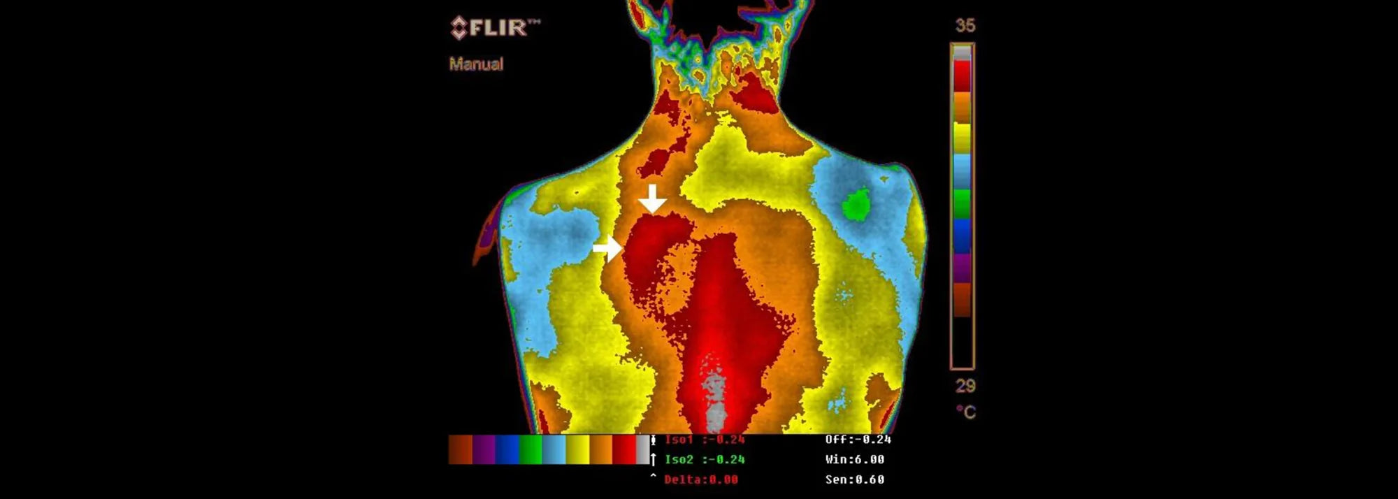 studie_rueckenschmerzen_entzuendung_vor_erdung
